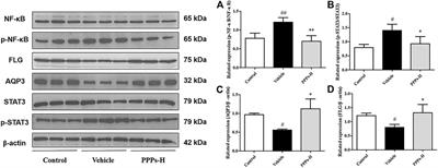 P. granatum Peel Polysaccharides Ameliorate Imiquimod-Induced Psoriasis-Like Dermatitis in Mice via Suppression of NF-κB and STAT3 Pathways